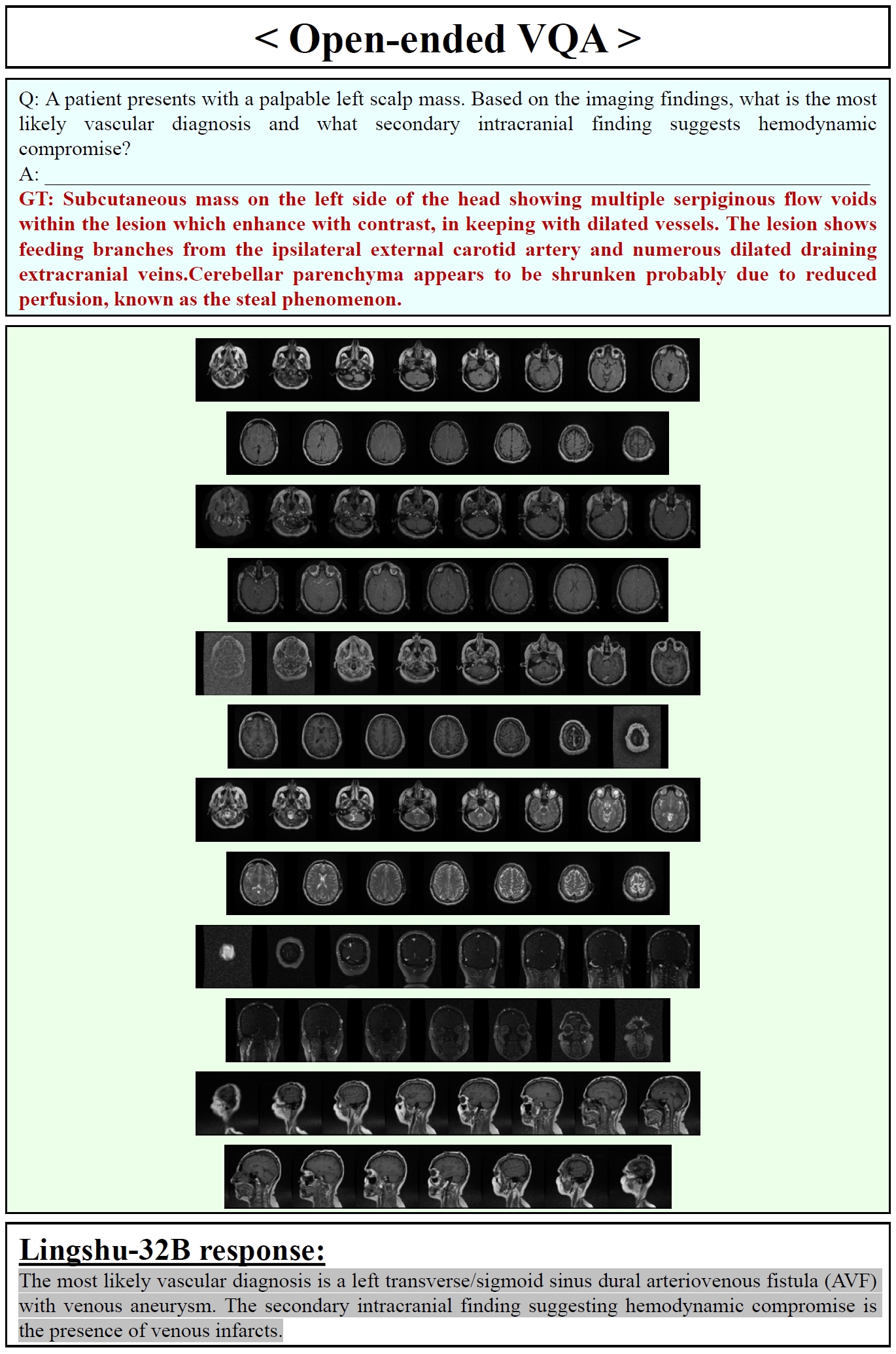 Lingshu-32B Open-ended VQA Samples